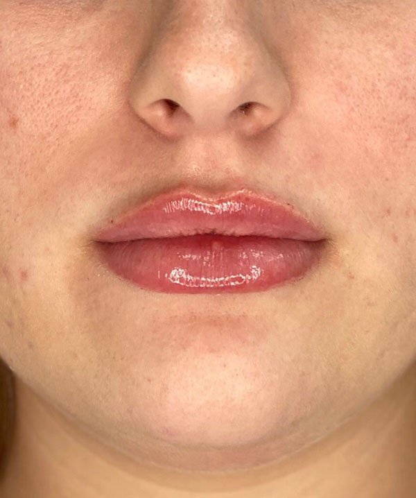 russian lips after